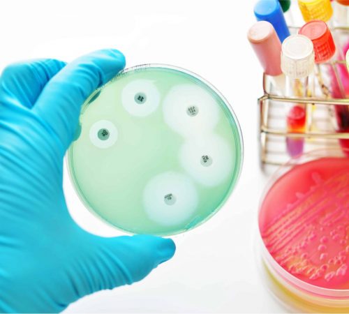 Extensively drug-resistant tuberculosis (XDR-TB)